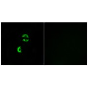 Immunofluorescence analysis of A549 cells, using LDLRAD3 antibody.