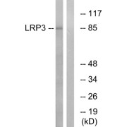 Western blot analysis of extracts from RAW264.7 cells, using LRP3 antibody.