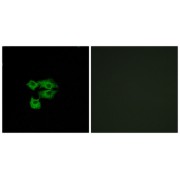 Immunofluorescence analysis of A549 cells, using LY6E antibody.