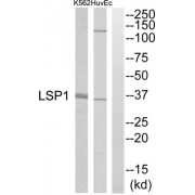 Western blot analysis of extracts from HuvEc cells and K562 cells, using LSP1 antibody.