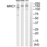 Western blot analysis of extracts from K562 cells, A549 cells and NIH-3T3 cells, using MRC1 antibody. The lane on the extreme right was treated with synthetic peptide.