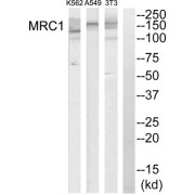 Western blot analysis of extracts from K562 cells, A549 cells and NIH-3T3 cells, using MRC1 antibody. The lane on the extreme right was treated with synthetic peptide.