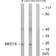 Western blot analysis of extracts from Jurkat cells and COLO cells, using MED18 antibody.