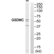 Western blot analysis of extracts from 293 cell, using GSDMC antibody.