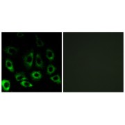 Immunofluorescence analysis of A549 cells, using MBTPS2 antibody.