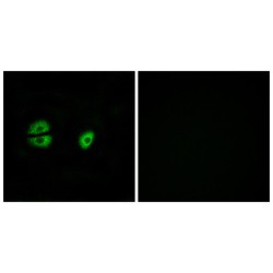 Mitochondrial Ribosomal Protein S22 (MRPS22) Antibody