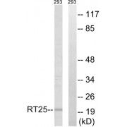 Western blot analysis of extracts from 293 cells, using MRPS25 antibody.