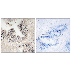 Mitochondrial Ribosomal Protein S36 (MRPS36) Antibody