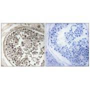 Immunohistochemistry analysis of paraffin-embedded human testis tissue using MRPS5 antibody.