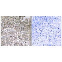 Solute Carrier Family 25 Member 21 (SLC25A21) Antibody