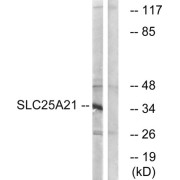 Western blot analysis of extracts from HepG2 cells, using SLC25A21 antibody.