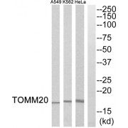 Western blot analysis of extracts from HeLa cells, K562 cells and A549 cells, using TOMM20 antibody.