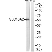 Western blot analysis of extracts from K562 cells, using SLC16A2 antibody.