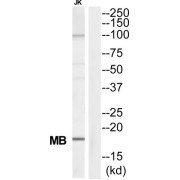 Myoglobin (MB) Antibody