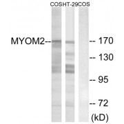 Western blot analysis of extracts from COS-7 cells and HT-29 cells, using MYOM2 antibody.
