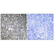 Immunohistochemistry analysis of paraffin-embedded human lymph node tissue using MPRIP antibody.