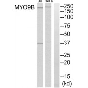 Western blot analysis of extracts from HeLa cells and Jurkat cells, using MYO9B antibody.