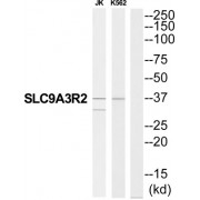 Western blot analysis of extracts from JK cells and K562 cells, using SLC9A3R2 antibody.