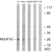 Western blot analysis of extracts from Jurkat cells, HeLa cells, HepG2 cells and MCF-7 cells, using NDUFV2 antibody.