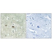 Immunohistochemistry analysis of paraffin-embedded human brain tissue using NDUFV3 antibody.