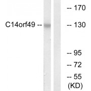 Western blot analysis of extracts from Jurkat cells, using C14orf49 antibody.