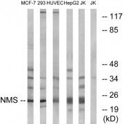 Western blot analysis of extracts from MCF-7 cells, 293 cells, HUVEC cells, HepG2 cells and Jurkat cells, using NMS antibody.