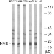 Western blot analysis of extracts from MCF-7 cells, 293 cells, HUVEC cells, HepG2 cells and Jurkat cells, using NMS antibody.