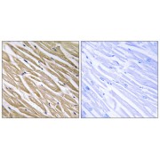 Immunohistochemistry analysis of paraffin-embedded human heart tissue using C5orf13 antibody.