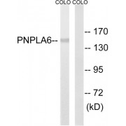 Western blot analysis of extracts from COLO205 cells, using PNPLA6 antibody. The lane on the right was bloacked with synthetic peptide.