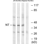 Western blot analysis of extracts from Jurkat cells, HUVEC cells and HepG2 cells, using NT antibody.