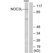 Western blot analysis of extracts from K562 cells, using NOC3L antibody.