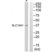 Western blot analysis of extracts from Jurkat cells, using SLC15A1 antibody.