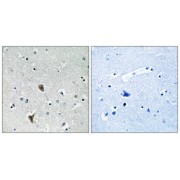 Immunohistochemistry analysis of paraffin-embedded human brain tissue using OXR1 antibody.