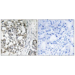 Peroxisomal Biogenesis Factor 14 (PEX14) Antibody