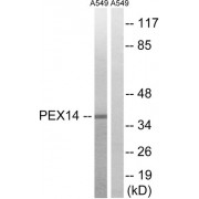 Western blot analysis of extracts from A549 cells, using PEX14 antibody.