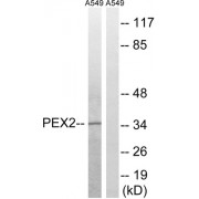 Western blot analysis of extracts from A549 cells, using PXMP3 antibody.