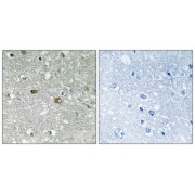 Immunohistochemistry analysis of paraffin-embedded human brain tissue using PIGH antibody.