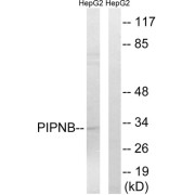 Western blot analysis of extracts from HepG2 cells, using PITPNB antibody.