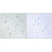 Immunohistochemistry analysis of paraffin-embedded human brain tissue using PLA1A antibody.