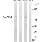Western blot analysis of extracts from HeLa cells, MCF-7 cells and HuvEc cells, using KCNA1 antibody.