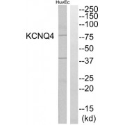 Western blot analysis of extracts from HuvEc cells, using KCNQ4 antibody.