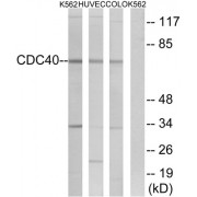 Western blot analysis of extracts from K562 cells, HUVEC cells and COLO cells, using CDC40 antibody.