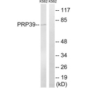 Western blot analysis of extracts from K562 cells, using PRPF39 antibody.