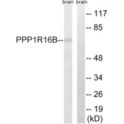 Western blot analysis of extracts from mouse brain cells, using PPP1R16B antibody.