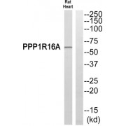 Western blot analysis of extracts from Rat heart cells, using PPP1R16A antibody.