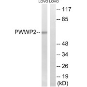 Western blot analysis of extracts from LOVO cells, using PWWP2B antibody.