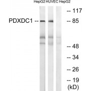 Western blot analysis of extracts from HepG2 cells and HUVEC cells, using PDXDC1 antibody.