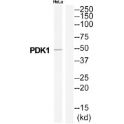 Pyruvate Dehydrogenase Kinase Isozyme 1 (PDK1) Antibody