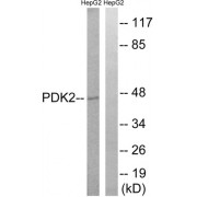 Western blot analysis of extracts from HepG2 cells, using PDK2 antibody.