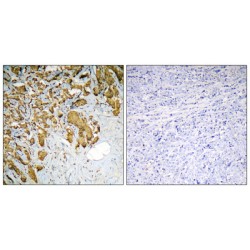 Pyruvate Dehydrogenase E1 Component Subunit Alpha, Somatic Form, Mitochondrial (PDHA1) Antibody